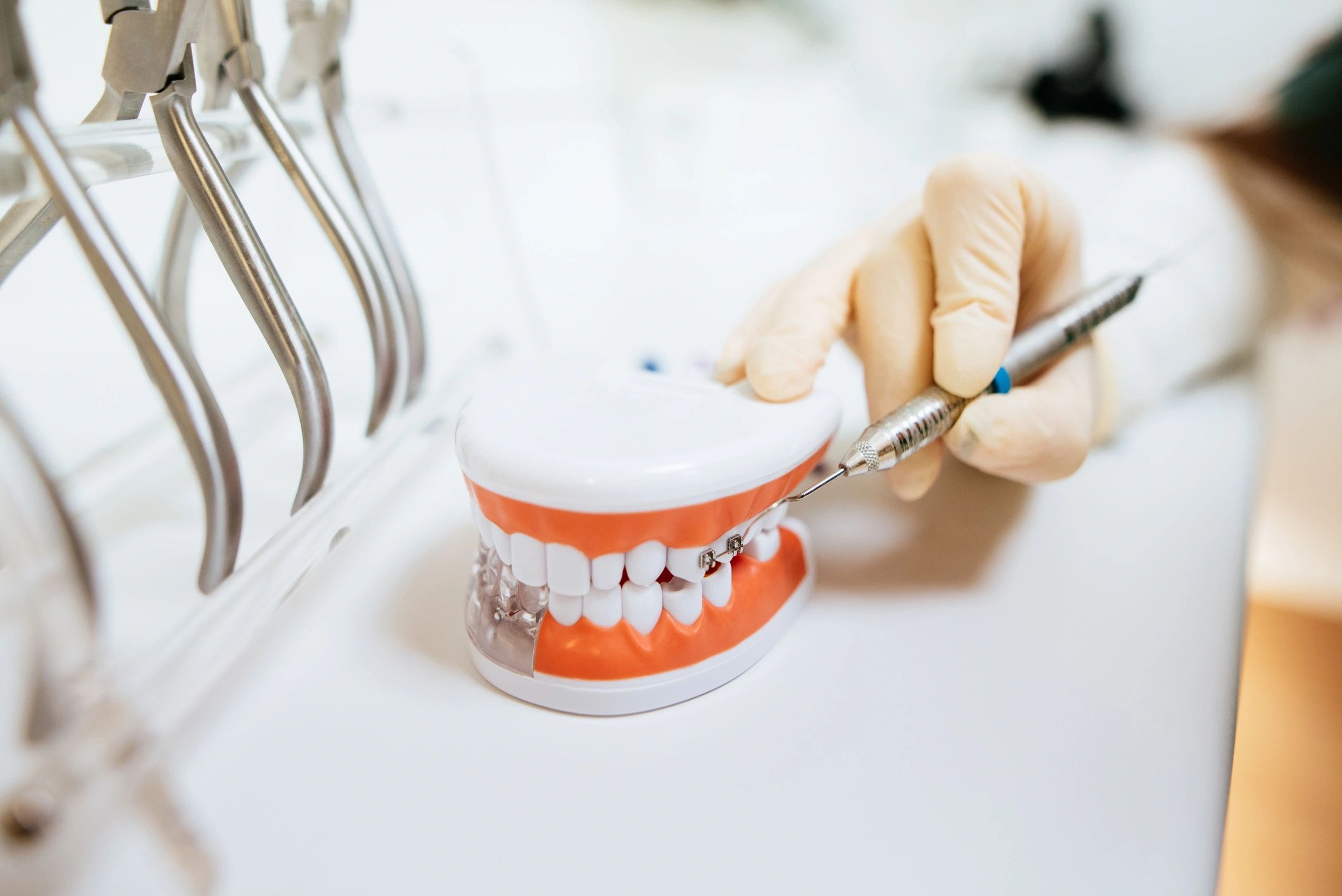 Dental model illustrating teeth and denture components